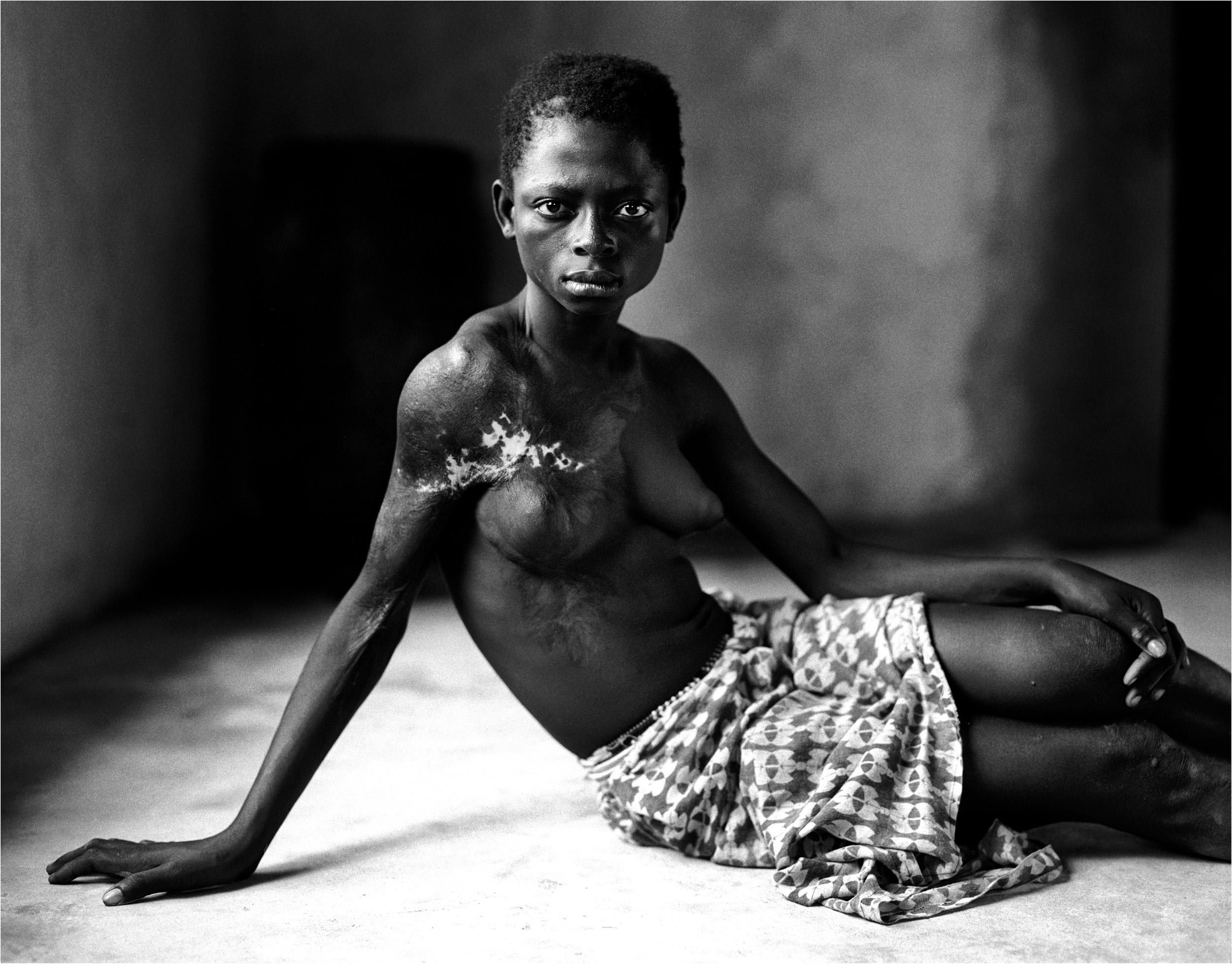 KONO, SIERRA LEONE-OCTOBER 2003: A 12 year old former "bush-wife" sex-slave of the rebel group the R.U.F. This girl was taken from her village at 10 years old and forced into sexual servitude by the rebels. When she attempted to escape they used ba
