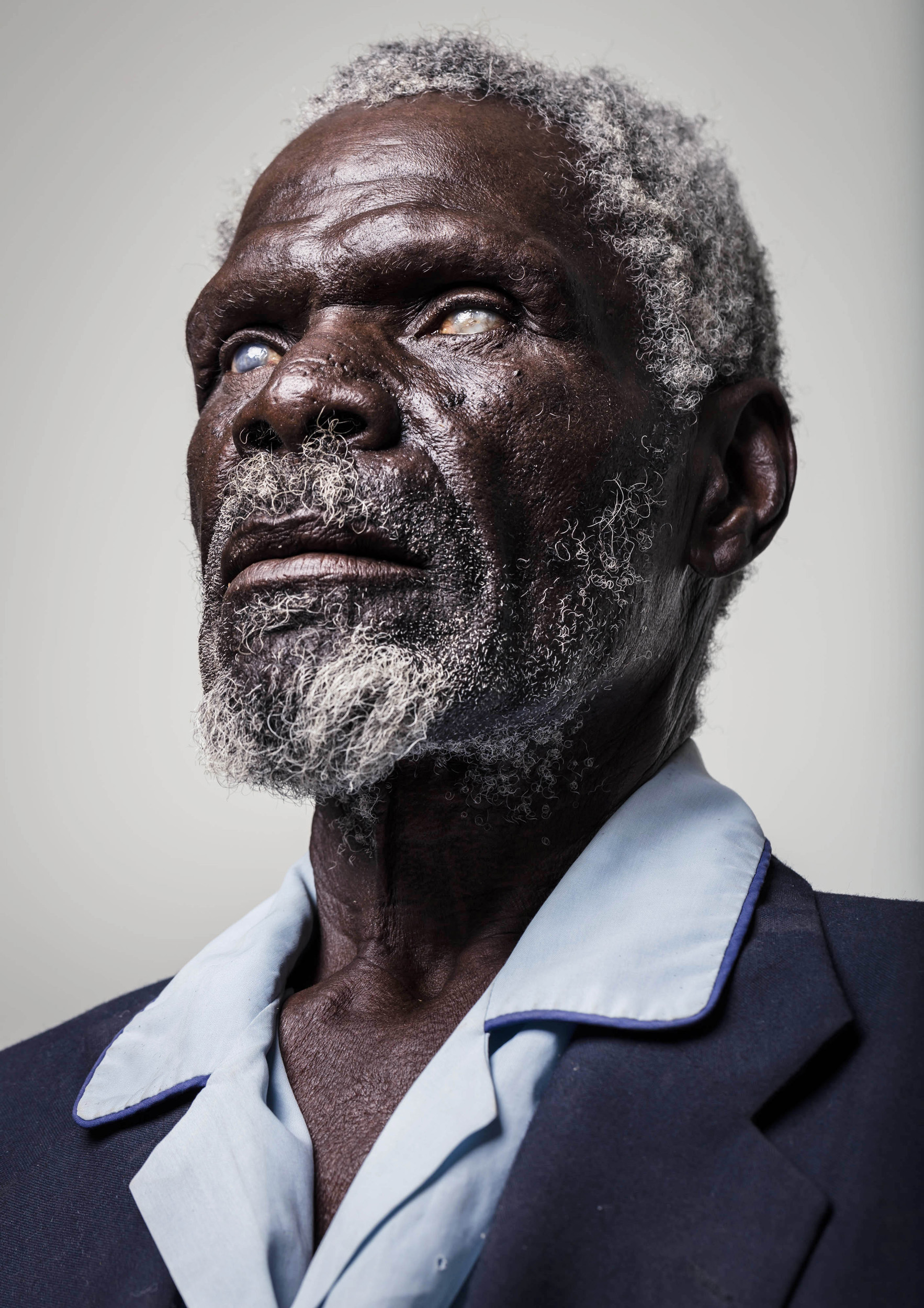 OMARURU, NAMIBIA, 5 November 2015: Gerd Gamanab, 67, is a completely sightless man hoping for a miracle at a blindness camp in Omaruru District hospital in Namibia. He lost his sight to 50 years of farm labour in the Namibian sun and dust, which des