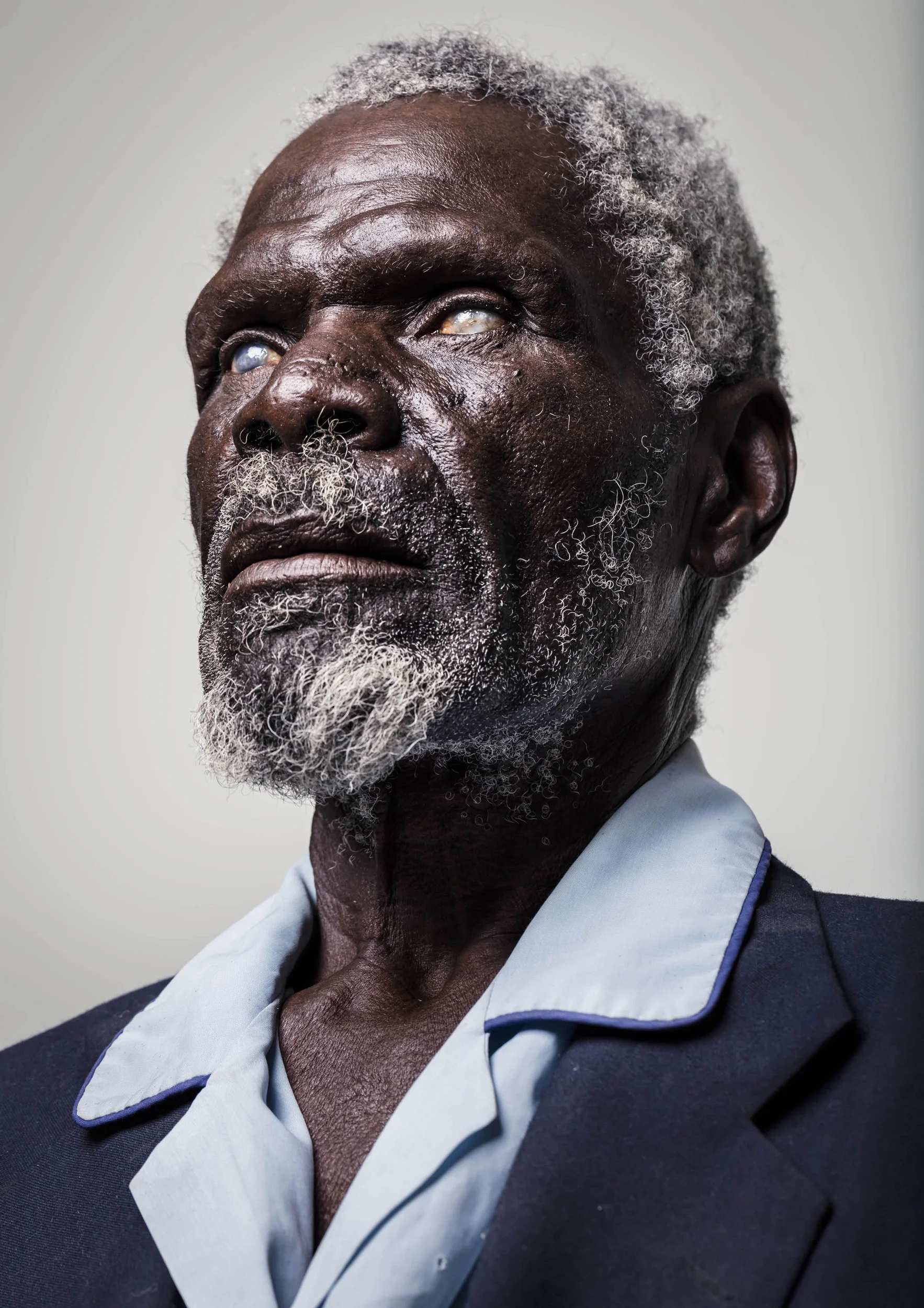 OMARURU, NAMIBIA, 5 November 2015: Gerd Gamanab, 67, is a completely sightless man hoping for a miracle at a blindness camp in Omaruru District hospital in Namibia. He lost his sight to 50 years of farm labour in the Namibian sun and dust, which destroyed both of his corneas. This kind of blindness is the result of living in remote locations with prolonged exposure to fierce elements and no eye care anywhere nearby. A lack of education as to what was happening to his eyes also allowed this to occur.
These camps are held all over Namibia and cater to sections of the population that do not receive regular eye care, mostly as a result of poverty. The applicant are screened and if the diagnosis is a mature cataract, they are selected as candidates for a simple operation which in fifteen minutes lends signicant sight to their world. The cataract is removed by a surgical vacuum and a new lens in inserted. Bandages are removed the next day and in most cases a real improvement in vision is the result. (Photo by Brent Stirton/Reportage for National Geographic Magazine.)