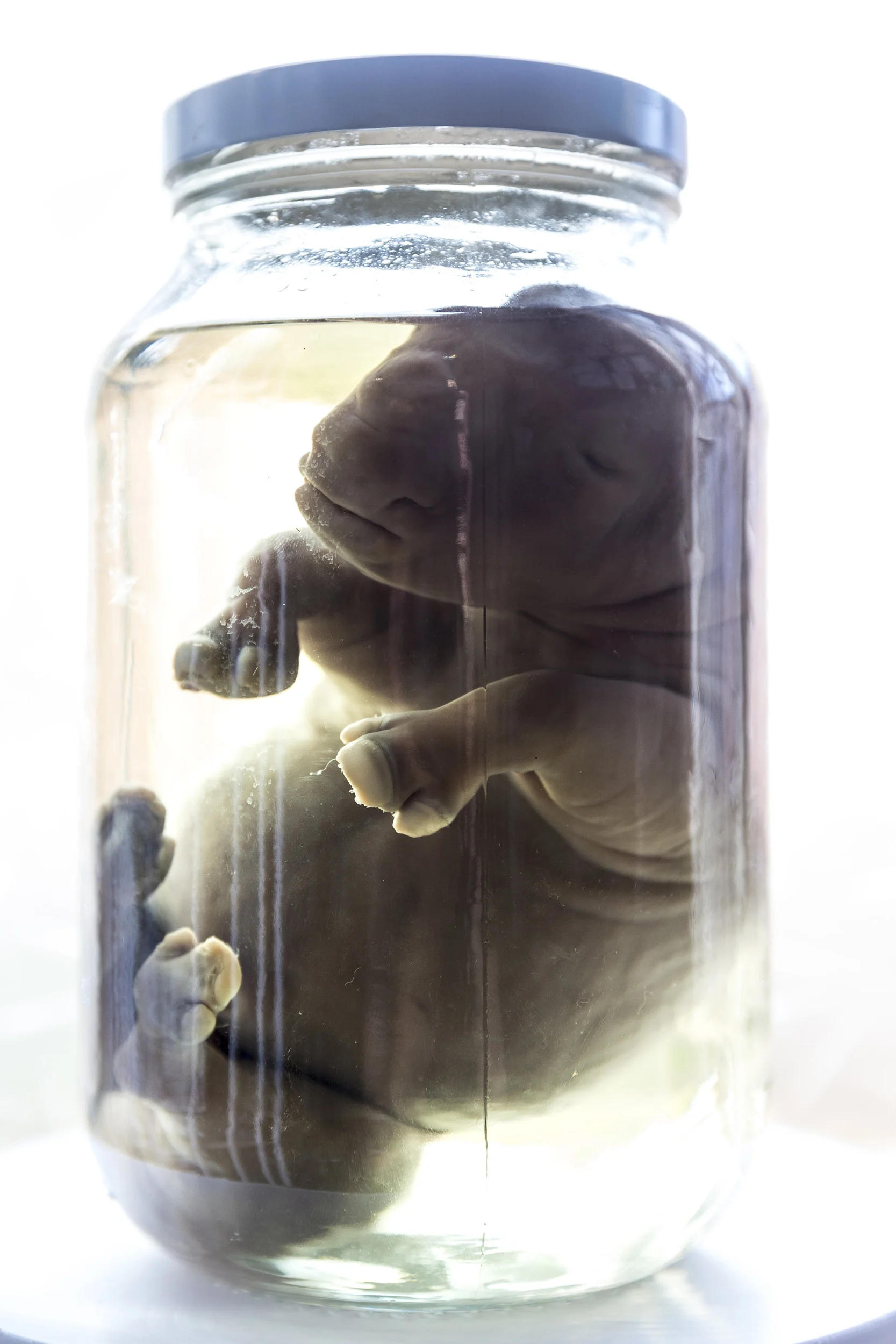 BUFFALO DREAM RANCH, KLERKSDORP, SOUTH AFRICA, 24 MAY 2016: An example of a Rhino Fetus taken from the womb of a dead Rhino. According to Dr Michelle Otto, Vet for the world largest rhino breeder, 80% of all poached rhino are female and pregnant. This doubles the number of rhino being lost in the current poaching crisis, a fact that often goes unmentioned when numbers are reported. It is also easier for poachers to track a group of White Rhino and those are usually females who are more social and gregarious than Bulls. Females also often have a calf with them and they will stay to defend the calf rather than run, that often makes them an easier target for poachers. John Hume has close to 1400 Rhino on his property and they are constantly monitored by Dr Otto and by Hume’s Security teams. Hume’s running costs are close to 5 million Rand a month, around $330, 000.00 per month. He is a long time proponent of legalizing the Rhino horn trade and is one of the biggest influences in trying to get CITES to change their trade stance. Hume is reputed to have more than 5 tons of rhino horn in secure locations. This would be worth around $40, 000, 000.00 on the Asian market at current prices. There are many supporters of the pro-trade agreement, with more than 1300 rhino likely to be poached per annum in this current crisis. Critics of trade state that legalizing horn trade would create loopholes that would exacerbate the killing of rhino. (Photo by Brent Stirton/Reportage by Getty Images for National Geographic Magazine.)