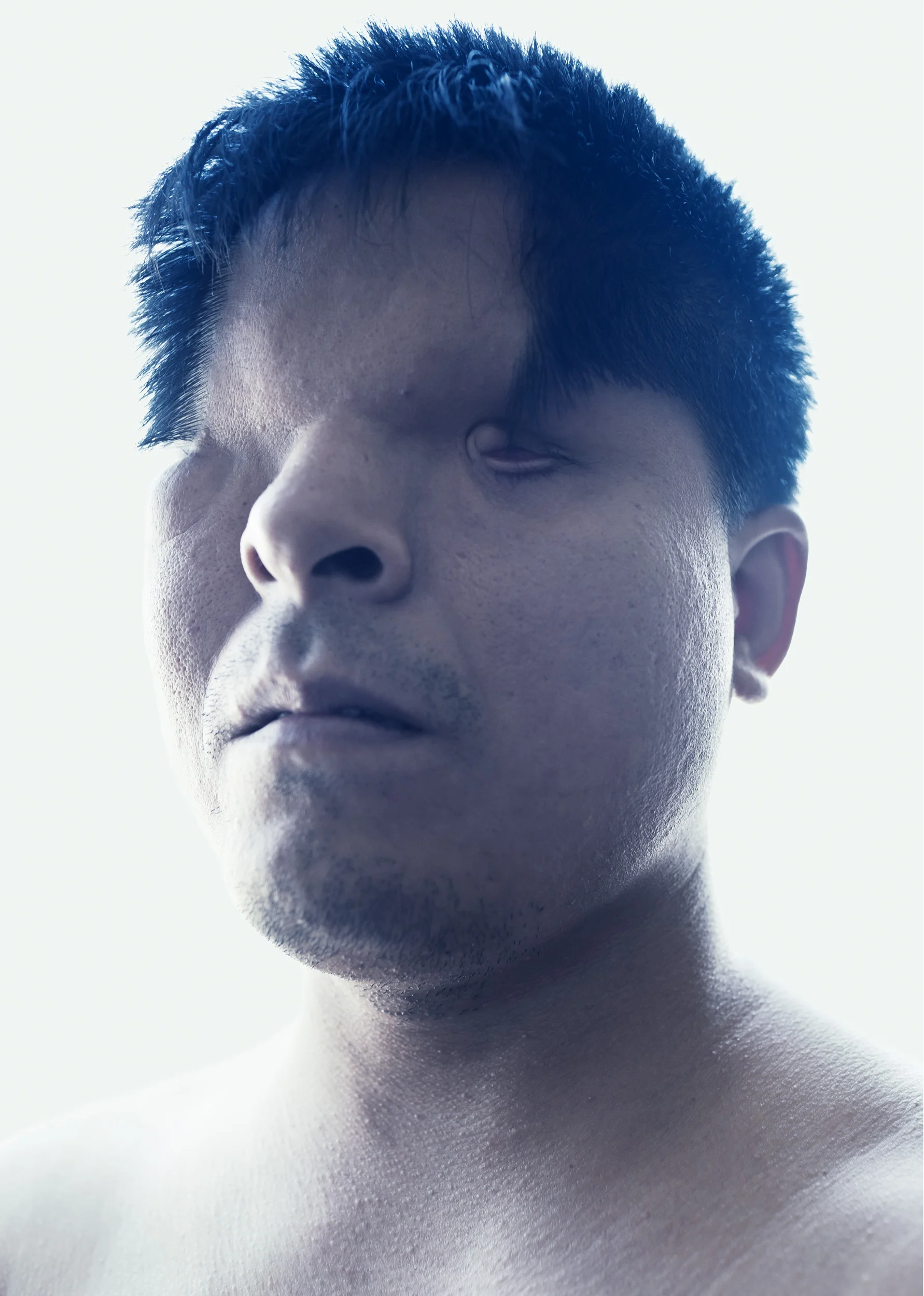 HANOI, VIETNAM, OCTOBER 2011: Pham, 32, a man born without eyes due to Agent Orange contamination which affected his father while he fought as a soldier in the Vietnam war, Hanoi, Vietnam, October 10, 2011. (Photo by Brent Stirton.)