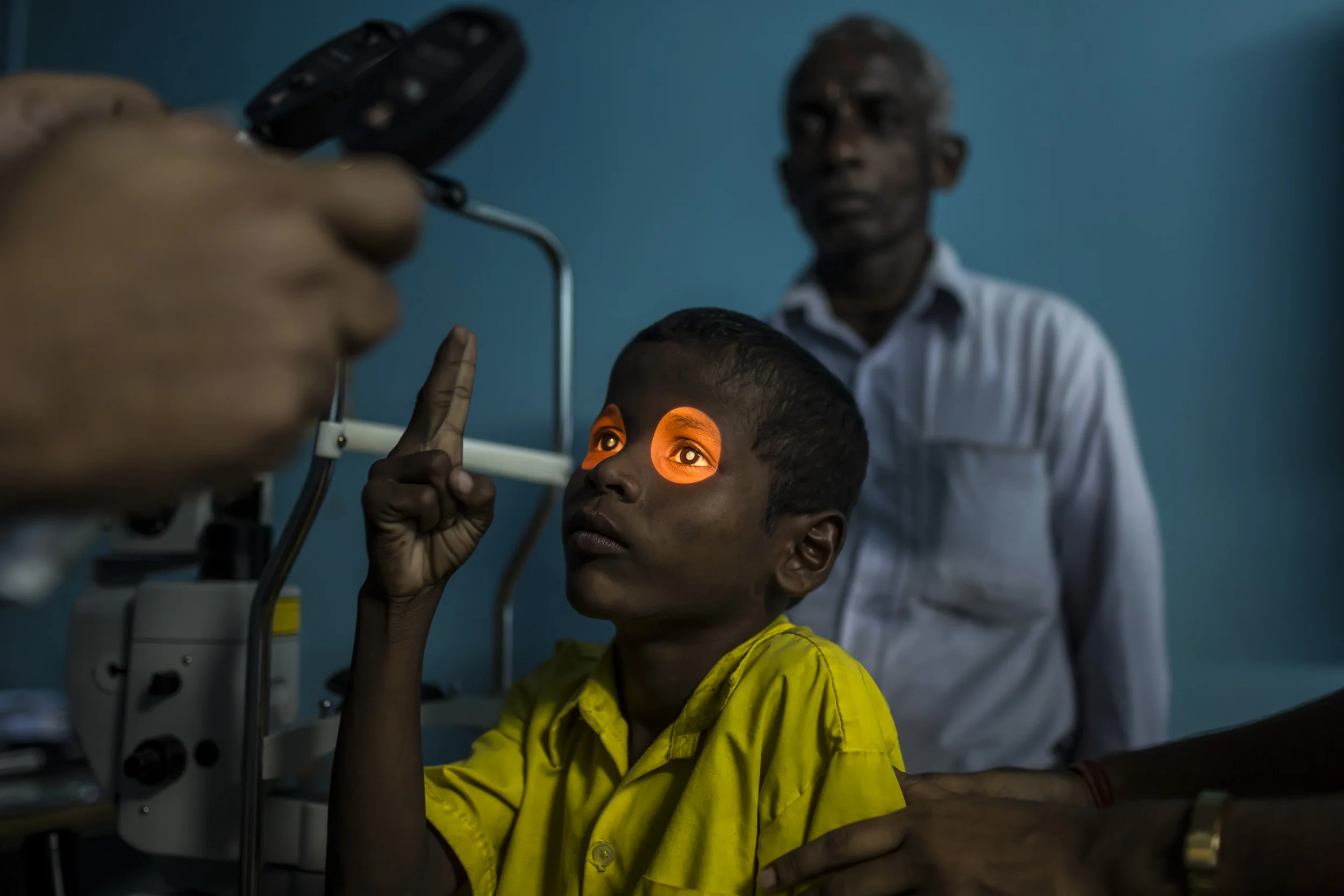 WEST BENGAL, INDIA, 17 SEPTEMBER 2014: Bharat Mallik, 7, is a boy who suffers from Cataract blindness and comes from a severely impoverished Bengali family in India. He is seen at Vivekananda Mission Hospital, an eye hospital which specializes in treating the poor for little or no money. Bharat’s father is a drunk and his labourer mother struggles to make ends meet. As a result he has not been treated for his cataracts. A teacher network at school notified a local social worker and as a result of his efforts Bharat is scheduled for surgery at Vivekananda Ashram hospital a few hours away. Most of these villagers are so poor that transport to a hospital is not possible. As a result many children go permanently blind when like Bharat, a simple operation can restore their sight. (Photo by Brent Stirton/Reportage by Getty Images.)