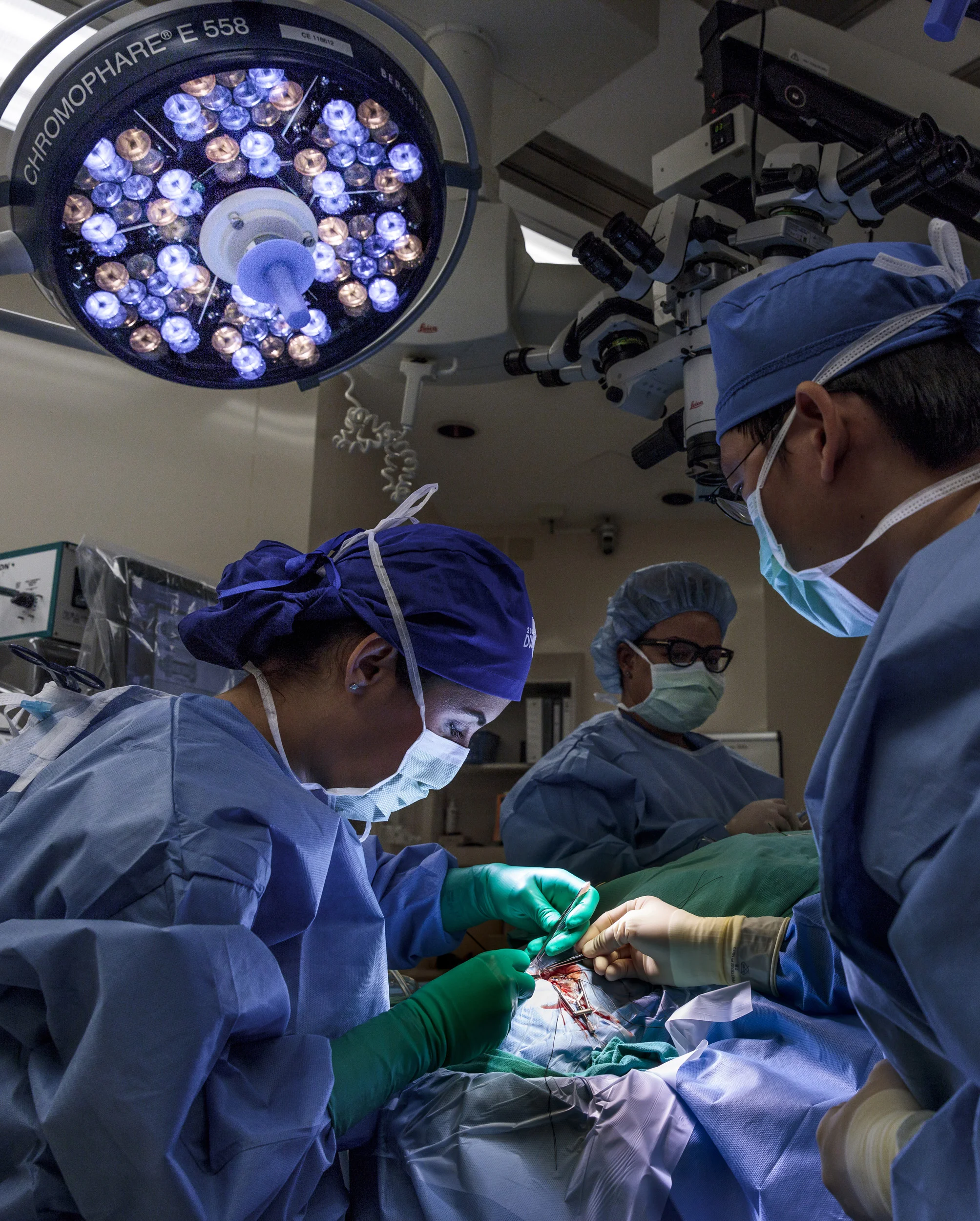 DUKE EYE CENTER, RALEIGH-DURHAM, NORTH CAROLINA, 9TH FEBRUARY 2016: Karen Brown, 59, was born with Retinitas Pigmentosa. As a result she experienced very limited sight as a child and then went blind. She is seen at Duke Eye center as eye surgeons implant an Argus 2 retinal implant which will lay an array of 60 electrodes across one of her eyes. This implant will connect to an external device which will bring Karen a version of the world around her translated into what will look light shapes and flashing lights. Second sight provides the following definition of the technology online: "The Argus® II Retinal Prosthesis System ("Argus II") is also known as the bionic eye or the retinal implant. It is intended to provide electrical stimulation of the retina to induce visual perception in blind individuals. It is indicated for use in patients with severe to profound retinitis pigmentosa. A miniature video camera housed in the patient's glasses captures a scene. The video is sent to a small patient-worn computer (i.e., the video processing unit – VPU) where it is processed and transformed into instructions that are sent back to the glasses via a cable. These instructions are transmitted wirelessly to an antenna in the retinal implant. The signals are then sent to the electrode array, which emits small pulses of electricity. These pulses bypass the damaged photoreceptors and stimulate the retina's remaining cells, which transmit the visual information along the optic nerve to the brain, creating the perception of patterns of light. Patients learn to interpret these visual patterns with their retinal implant." Karen is operated on by Dr Lejla M Vajzovic and assisted by Dr Paul Hahn at Duke Eye center. Around 150 patients have had the Argus 2 implant so far. It is described as similar to learning another visual language, once patients have learnt this language the world becomes visible to them in a way that could be desbribed as akin to a hazy black and white photograph. (