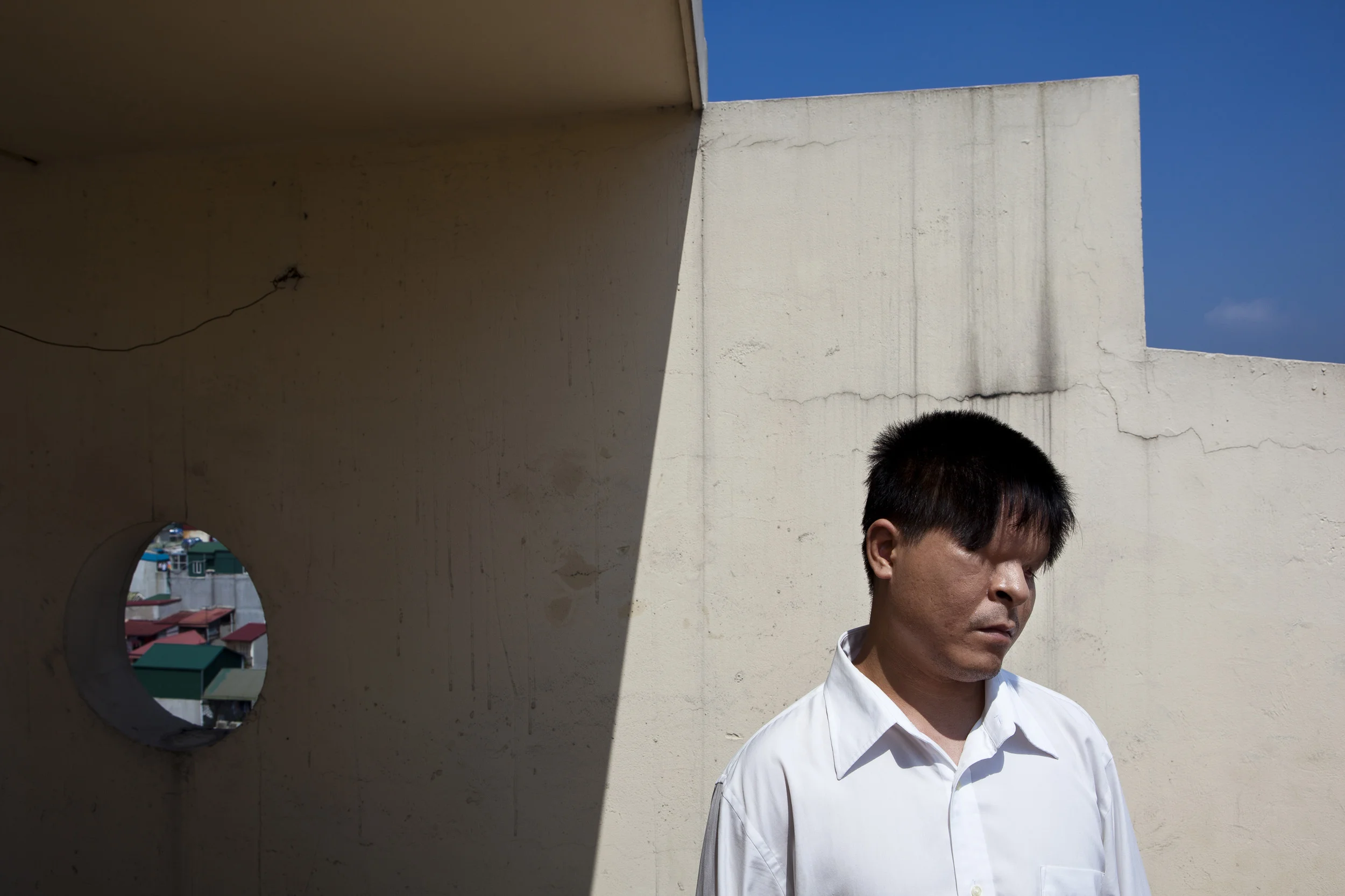 HANOI, VIETNAM, OCTOBER 2011: Pham, 32, a man born without eyes due to Agent Orange contamination which affected his father while he fought as a soldier in the Vietnam war, Hanoi, Vietnam, October 10, 2011. (Photo by Brent Stirton.)