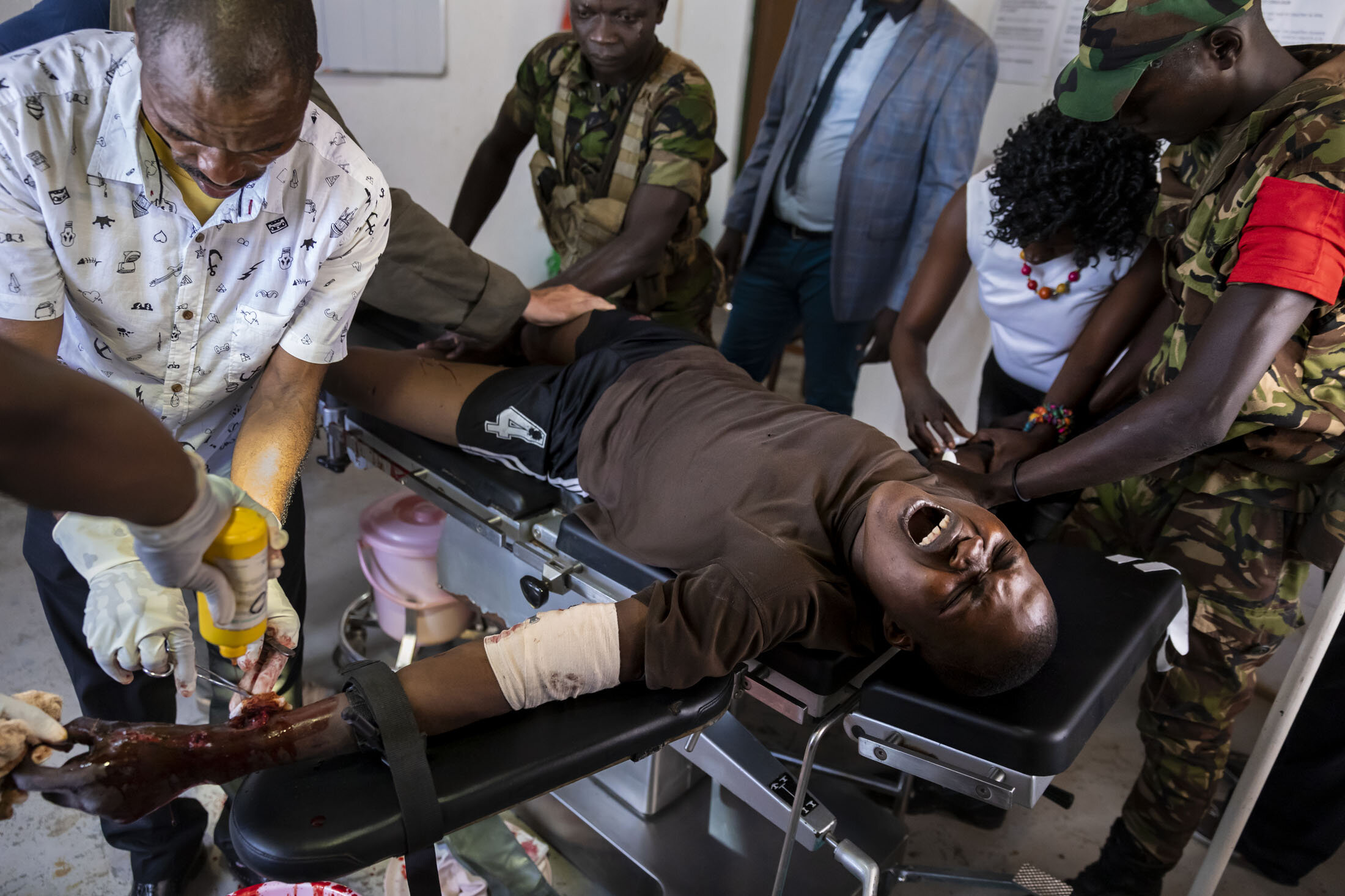 GARAMBA NATIONAL PARK, DEMOCRATIC REPUBLIC OF CONGO, APRIL 21 2019: Young Congolese conservation ranger Izako Vungunyesi is casevacked by helicopter after an incident with poachers inside the park. He was shot through the wrist and the AK 47 round a