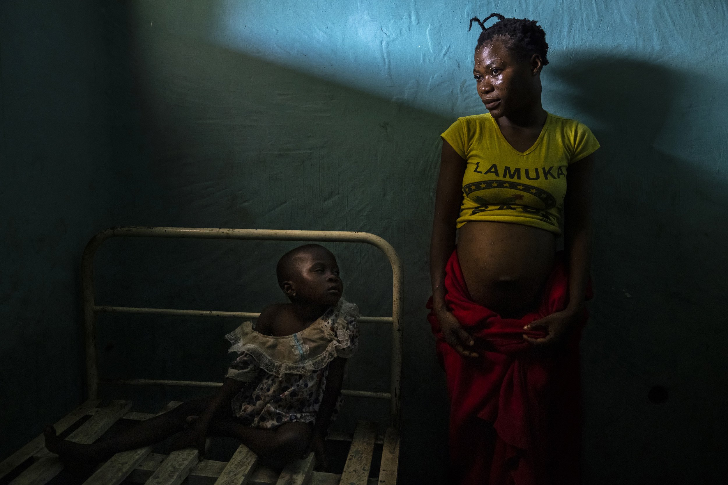 EQUATEUR PROVINCE, DEMOCRATIC REPUBLIC OF CONGO, 23 APRIL 2021: Blandine Bosaku, 18, is seen inside the isolation ward at Befale general clinic in remote Befale village with her daughter Anisha. Blandine is suffering from Monkeypox, a virus that is
