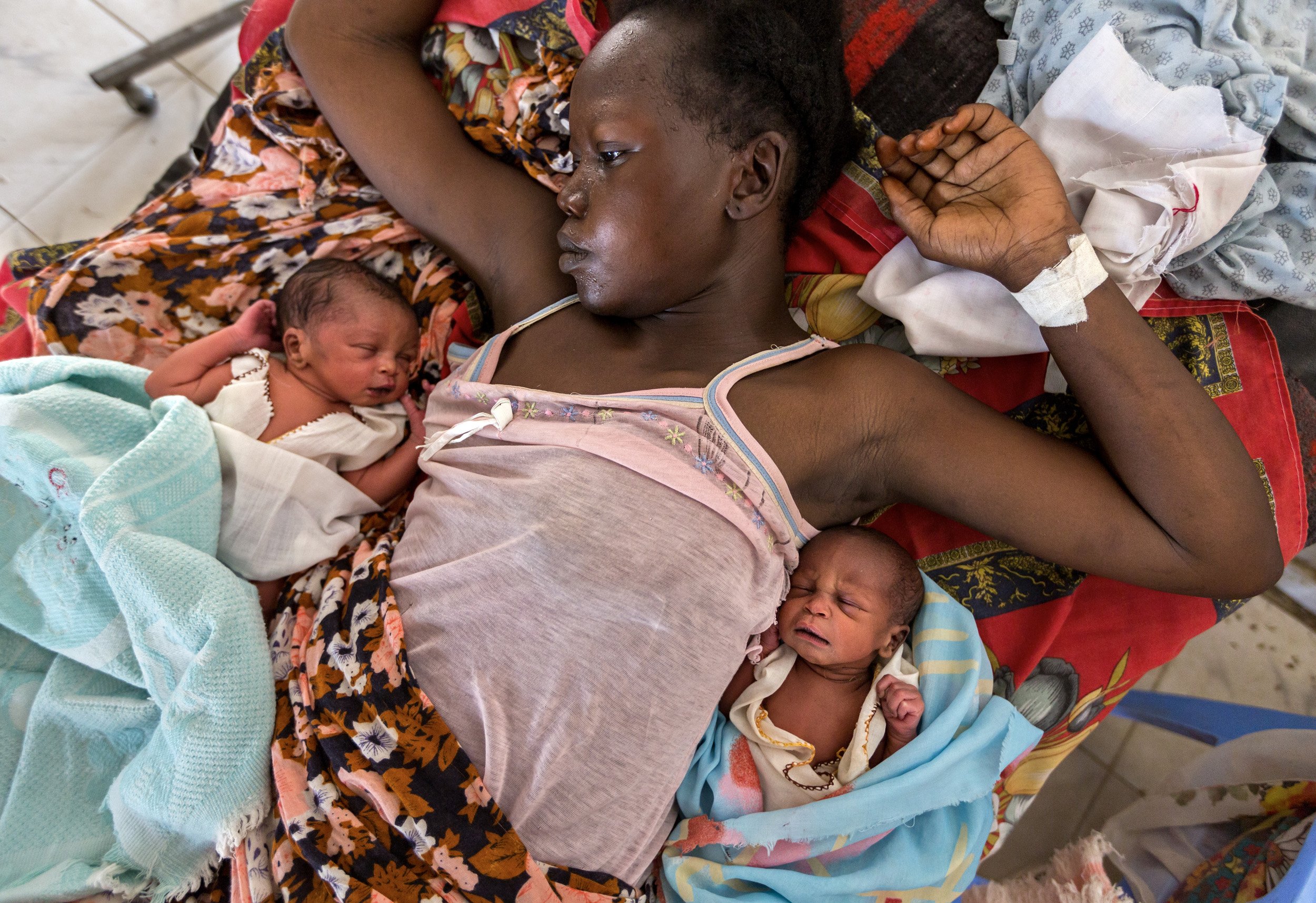 BOR, SOUTH SUDAN, FEBRUARY 2013: A young woman recovers after just giving birth to twins in the Bor Hospital maternity ward, Bor, South Sudan, February 9, 2013. Early marriage is common in South Sudan, with girls as young as 12 essentially sold into