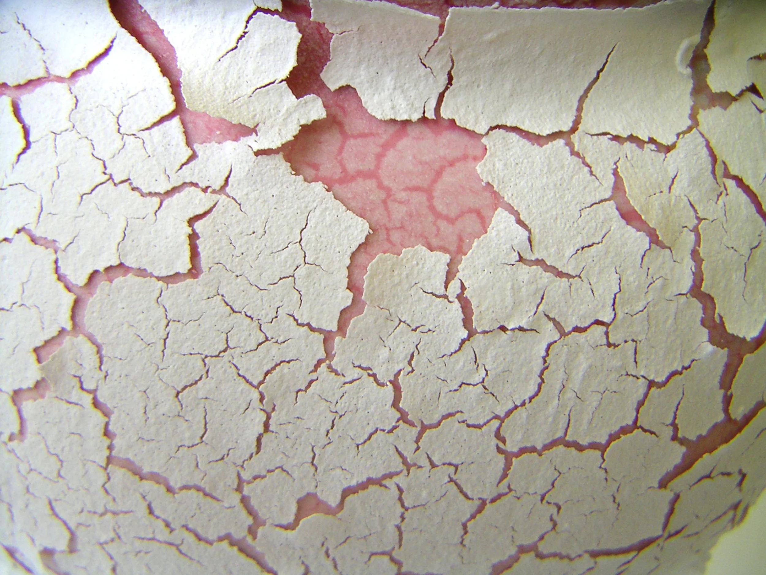 Skin2.jpg
