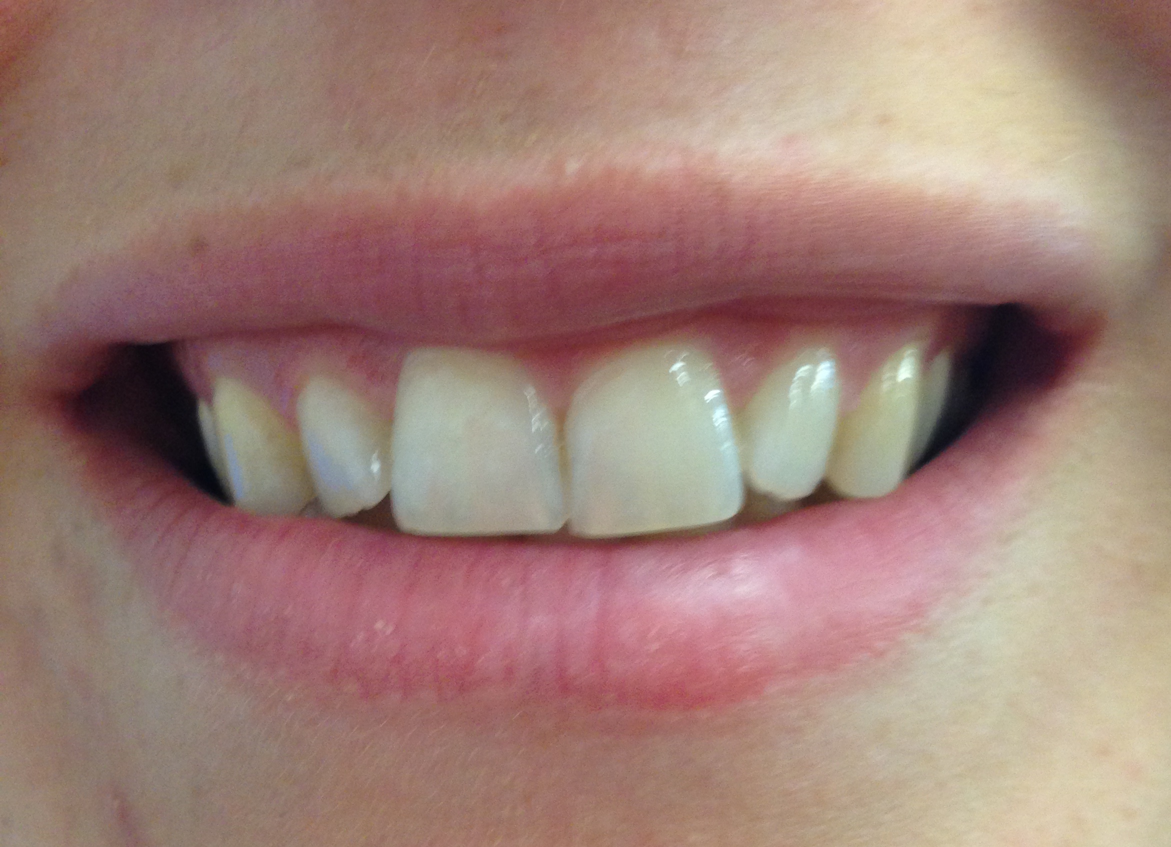 After...