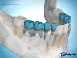 Protecting the Arch Length of the Developing Dentition — Commentary in