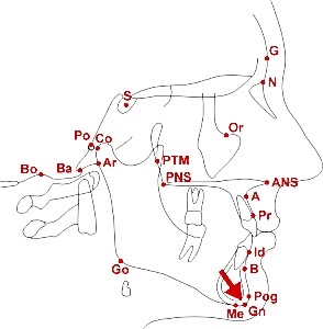 Point "Pog" depicted by red arrow