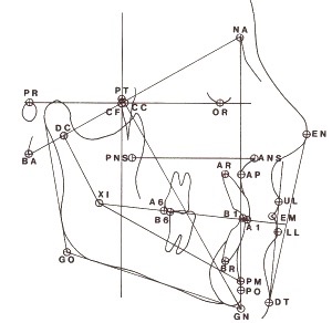  Ricketts Lateral Cephalogram