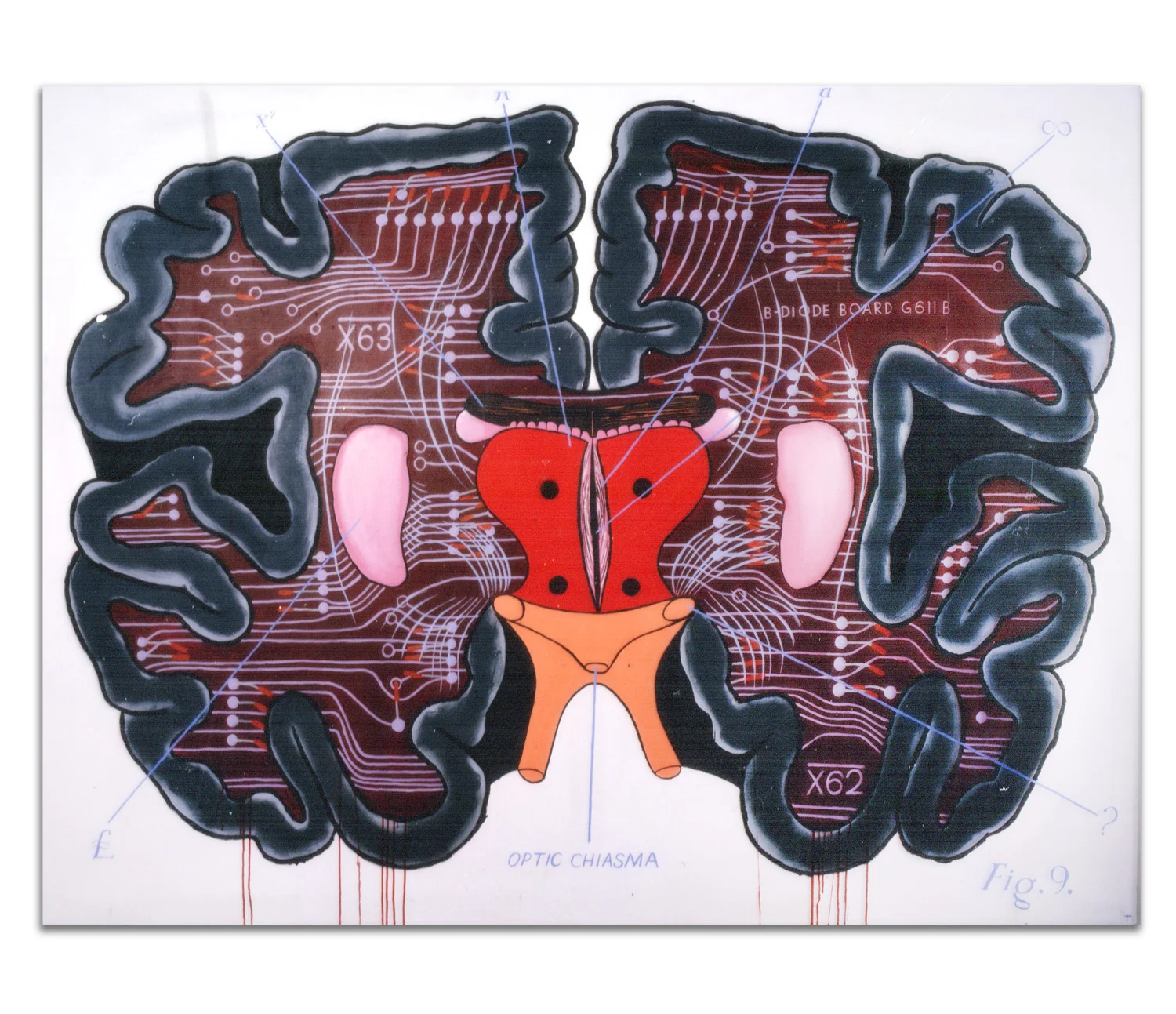 Cerebrum (1989)