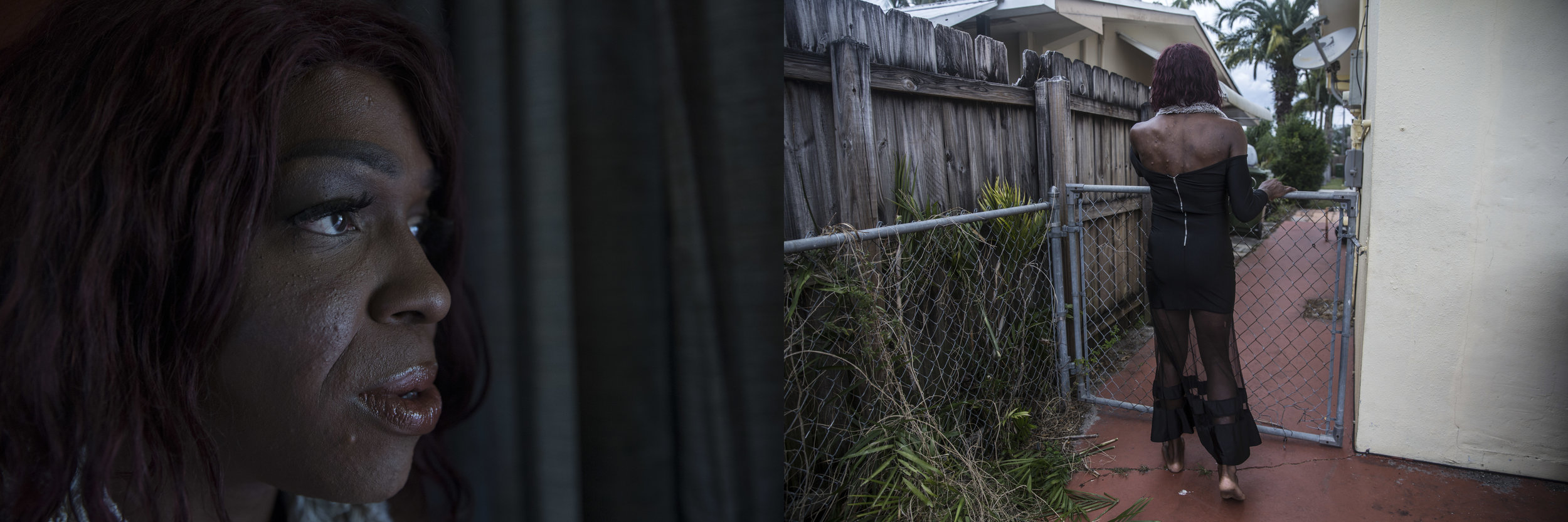   Aryah Lester, an HIV-positive trans woman, poses for a portrait and walks at her home in Fort Lauderdale, Florida, one of the US’ leaders in new HIV infections.  