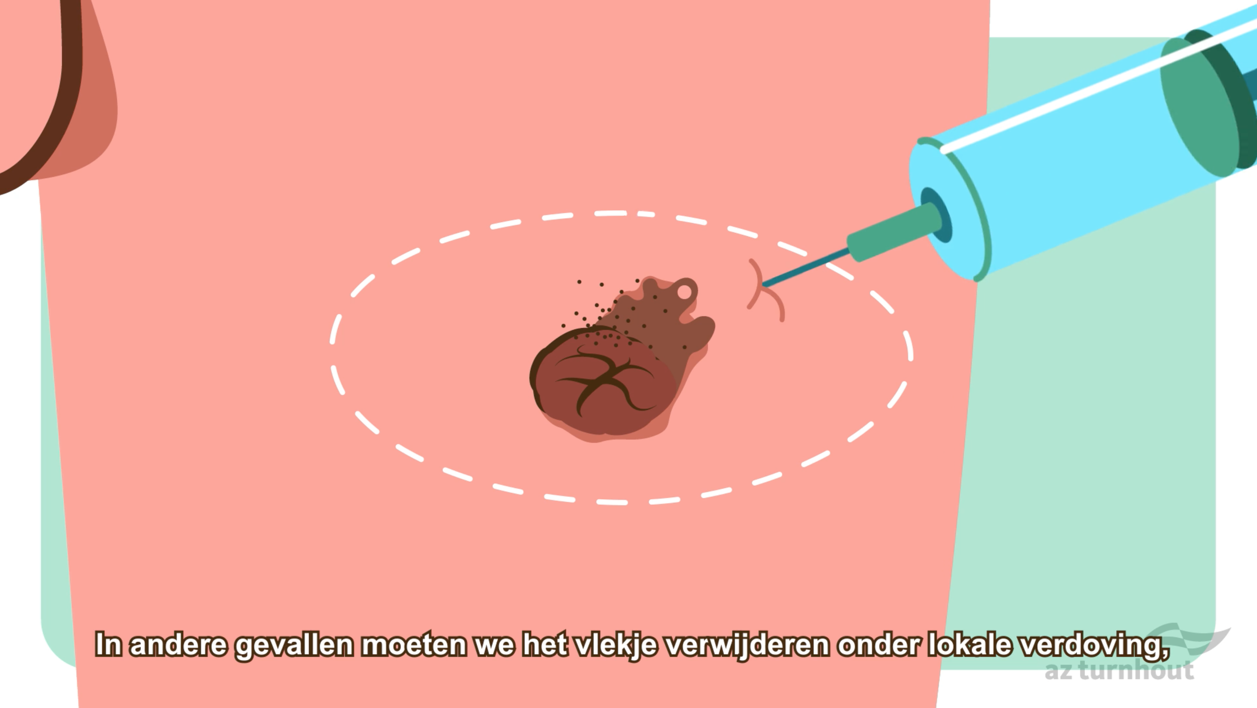 Waarom kiezen ziekenhuizen voor animatie?