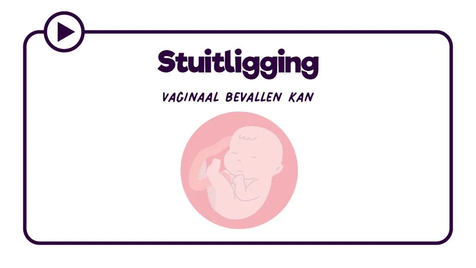 Thumb_Stuitbevalling_Kader_02.jpg