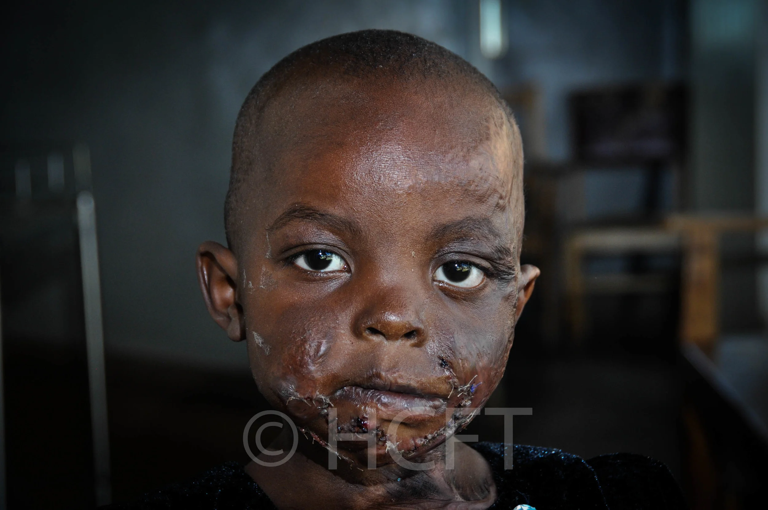 Terryanne Kwanboka Momanyi, 3yrs (1).jpg