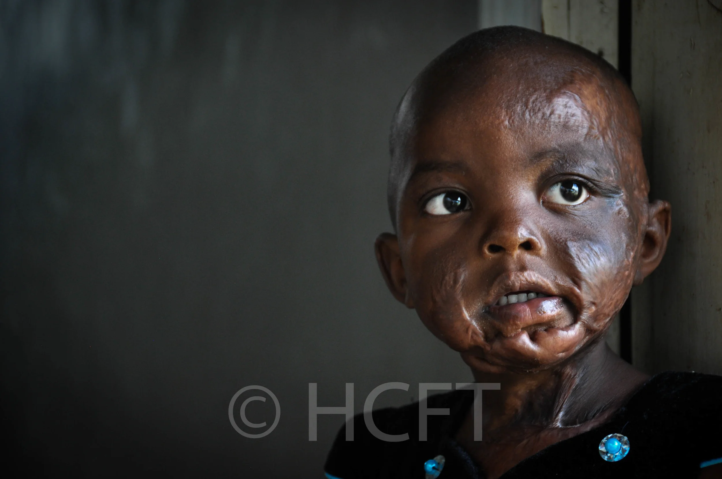Terryanne Kwanboka Momanyi, 3yrs (2).jpg