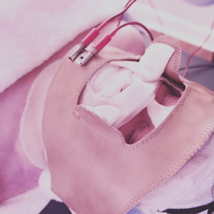 The Iderm Deep Ionization Skin Treatment has been our signature facial for over 16 years (and I&rsquo;ve personally been performing it since 1997) for one simple reason:
it&rsquo;s based on skin physiology, not surface-level pampering.

This treatmen