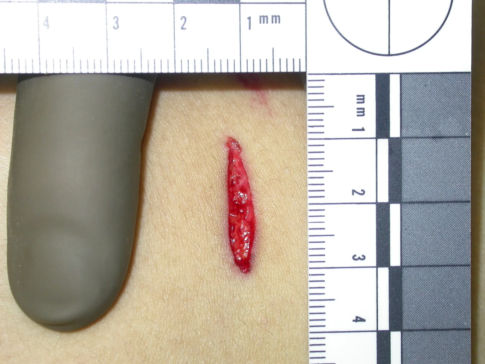 Measuring a knife wound: Image from:&nbsp;http://crimefictioncollective.blogspot.ca/2012/05/wrong-way-to-measure-knife-wound.html