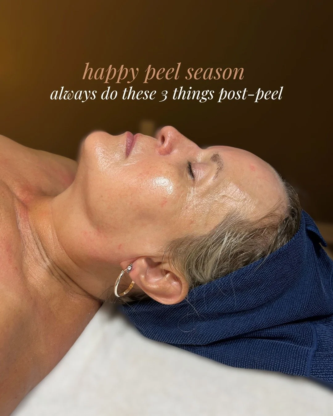 Happy Peel Season 👏😍
These are our top 3 post-peel care tips: 
1️⃣USE. SPF. EVERY. DAY. (not only will you regret it if you don't, but why would you pay money for a peel, then ruin it with sun exposure?)
2️⃣DO NOT pick or pull at any of the dead