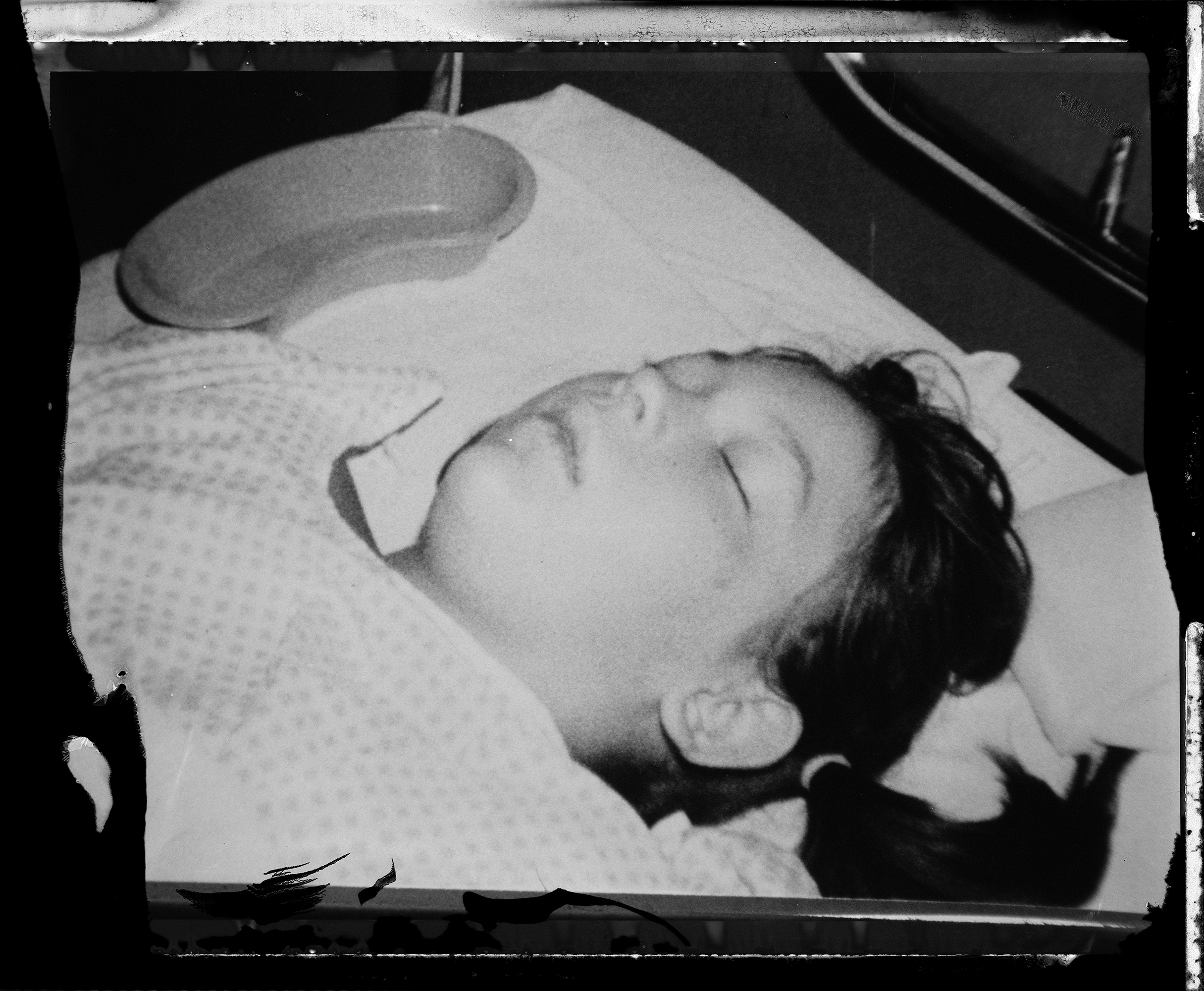 After 12 hour surgery, ©Mother