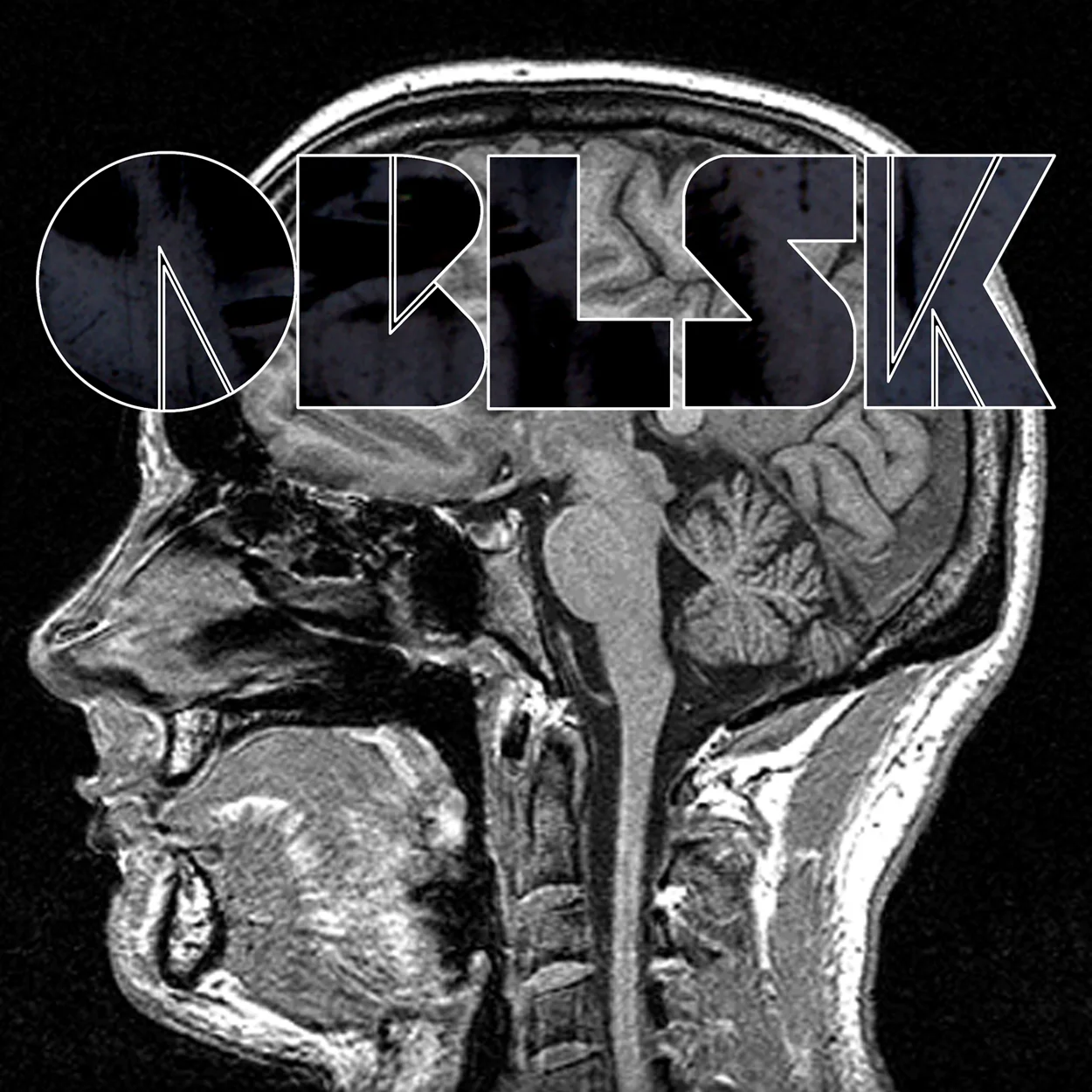 oblsk_brain.jpg