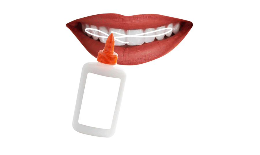 You've Got Something on Your Teeth