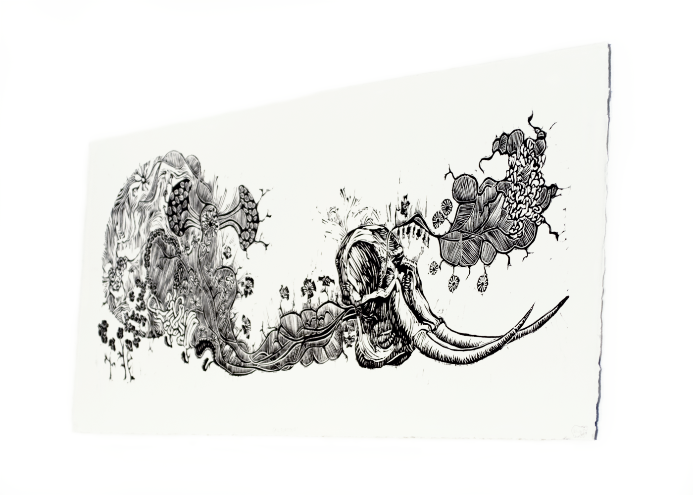 Gallbladders(Side)Web.png