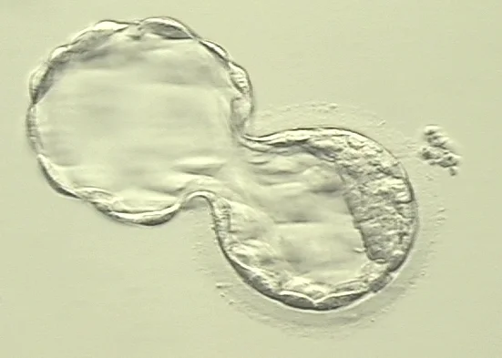 My son as a 5-day old embryo under a microscope. Early into the pregnancy he didn't make it. And while I will never hold him, I will always have this to heal my heart. To me, that is the power of a photograph.