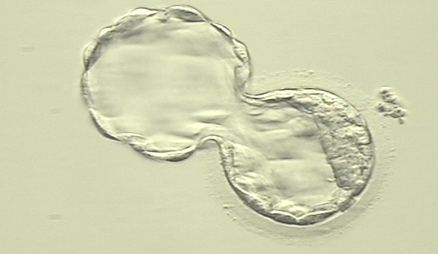 My son as a blastocyst. To any person who has ever lost a child at any stage, you are not alone. I see you. And I love you.