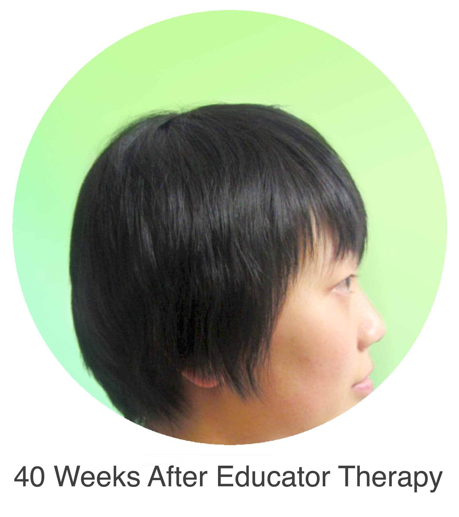 40 Weeks After Educator Therapy