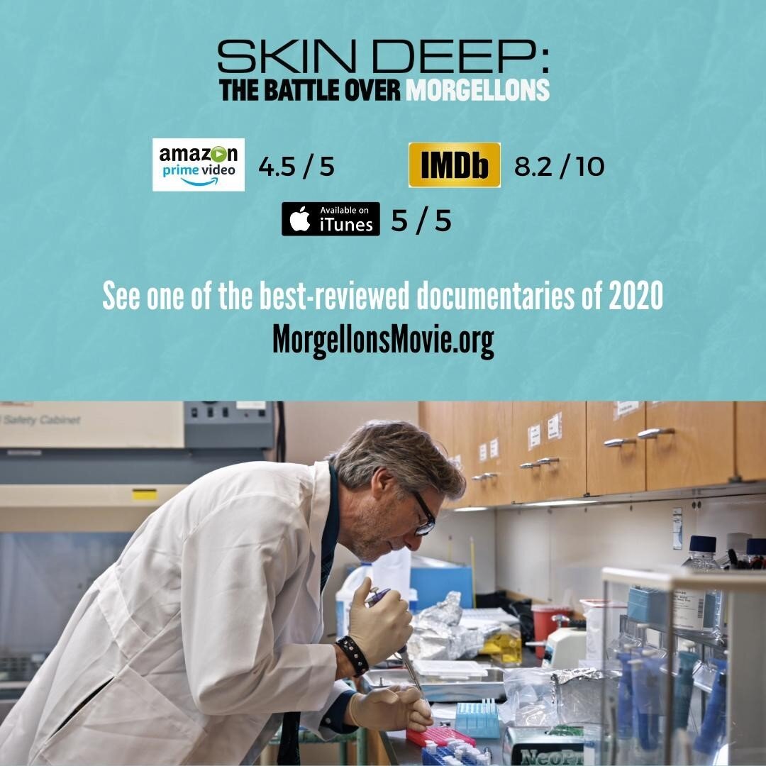 See one of the best-reviewed documentaries of 2020--Skin Deep: The Battle Over Morgellons on Amazon Prime &amp; worldwide on digital, DVD &amp; Blu-ray at MorgellonsMovie.org⁠
.⁠
.⁠
.⁠
#SkinDeep #MorgellonsMovie #MorgellonsDisease #Morgellons #Morgel
