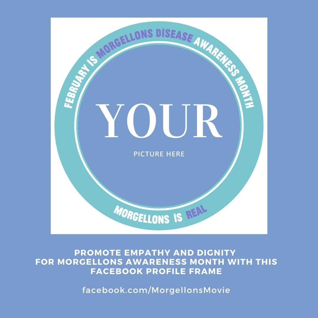 Promote Empathy and Dignity for Morgellons Disease Awareness month with this facebook profile frame.  Link:  http://bit.ly/3tT5n7s⁠
⁠
⁠
Skin Deep on Amazon Prime &amp; worldwide on digital, DVD &amp; Blu-ray at MorgellonsMovie.org⁠
.⁠
.⁠
.⁠
#SkinDeep