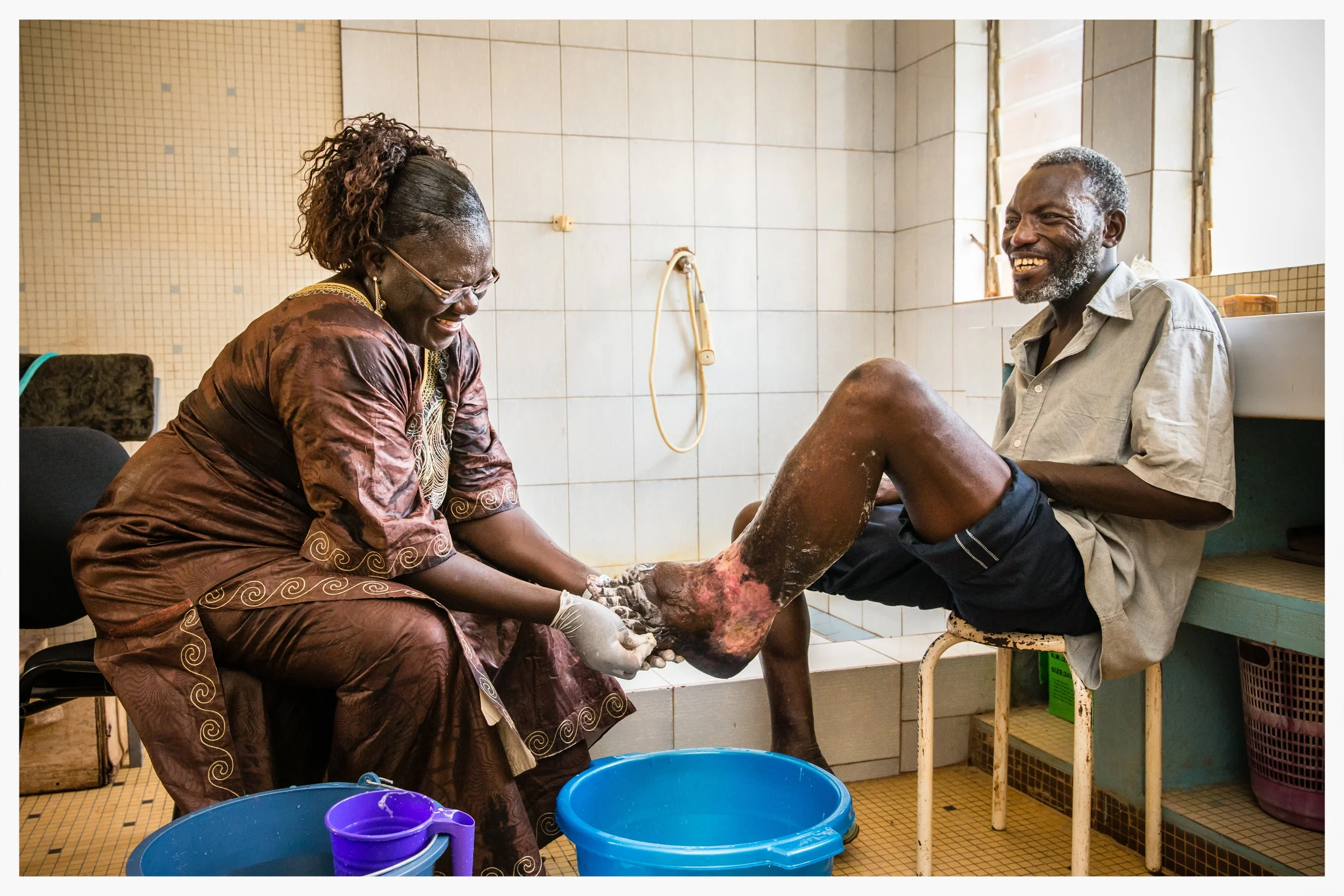 Lymphatic Filariasis, Burkina Faso. Photo: Marcus Perkins for GSK