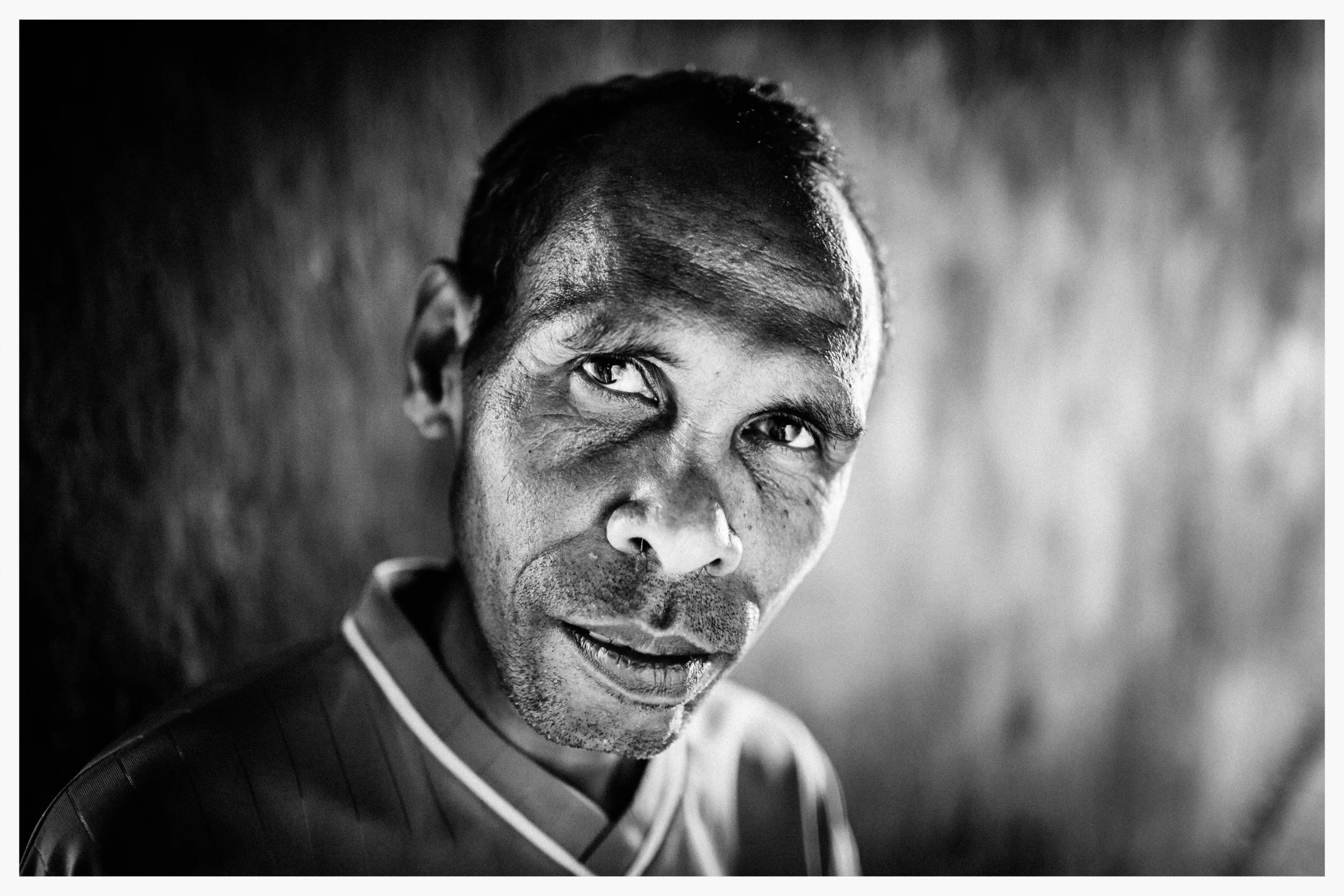 José Menezes Nunes Serrão survived an attempted beheading in April 1999. East Timor. Photo: © Marcus Perkins
