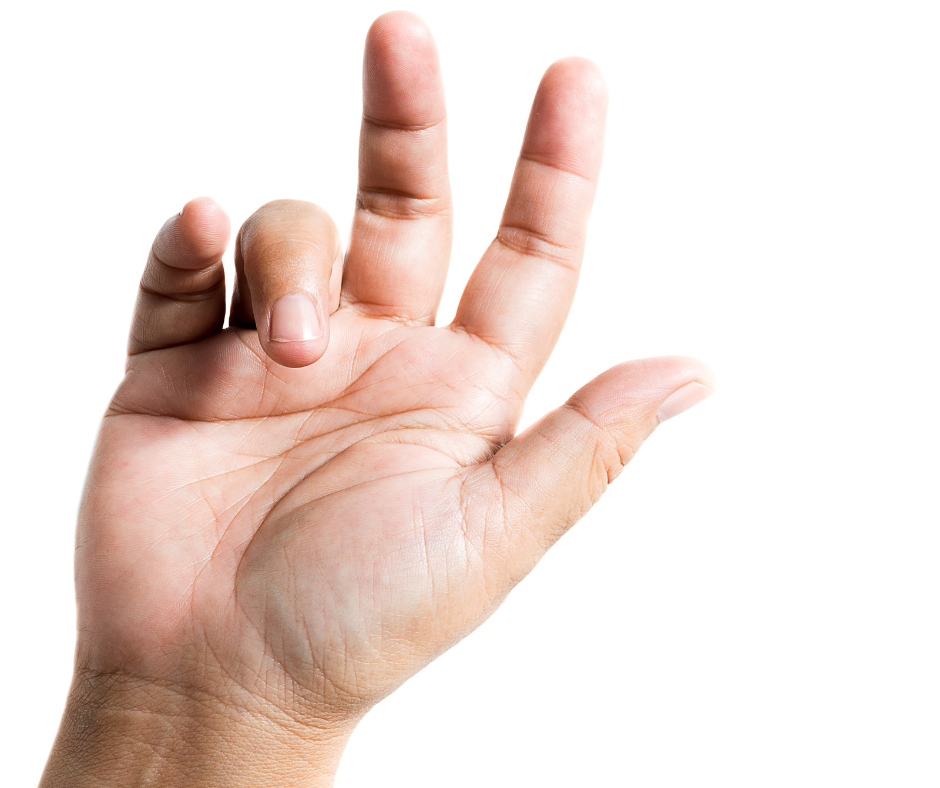 Trigger Finger In2it Medical