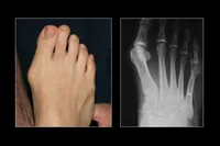 thumb-obw-003.jpg