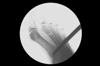 thumb-obw-005.jpg