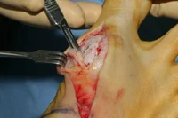 thumb-obw-010.jpg