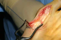 thumb-obw-012.jpg