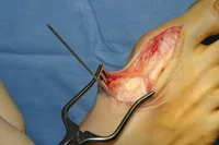 thumb-obw-013.jpg