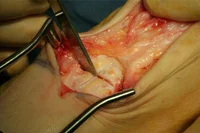 thumb-obw-018.jpg