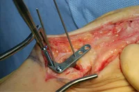 thumb-obw-028.jpg