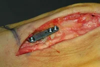 thumb-obw-036.jpg