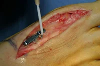 thumb-obw-037.jpg