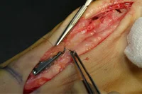 thumb-obw-038.jpg