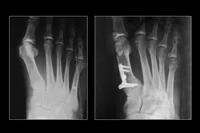 thumb-obw-044.jpg
