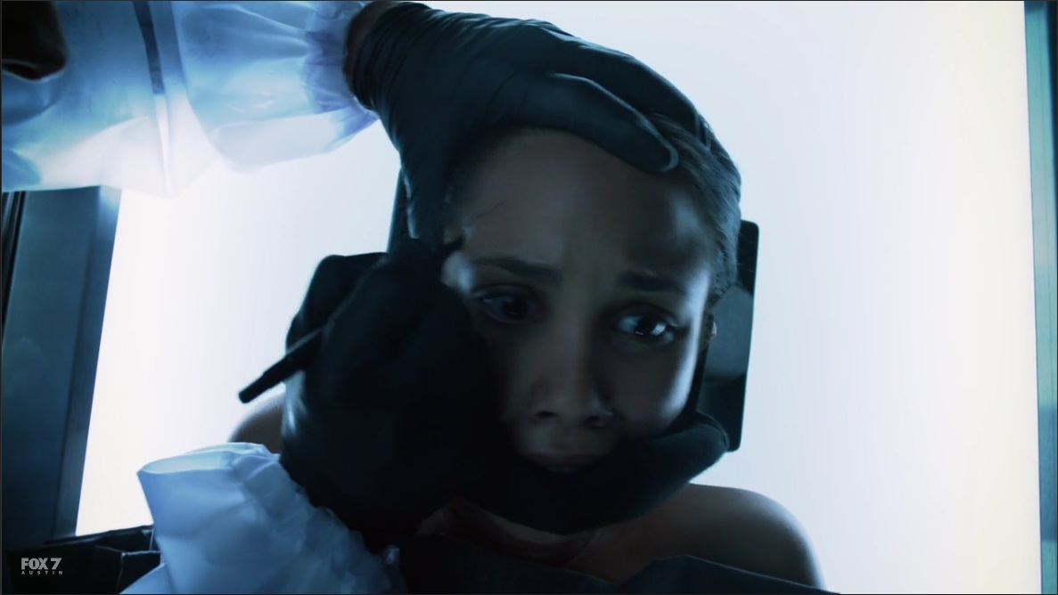 Dr. Symon starts to remove a victim's face.