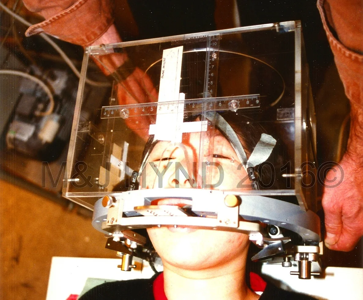the stereotactic frame fitted on the anchor